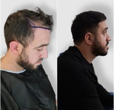 Slider image (10) Dali Hair Clinic